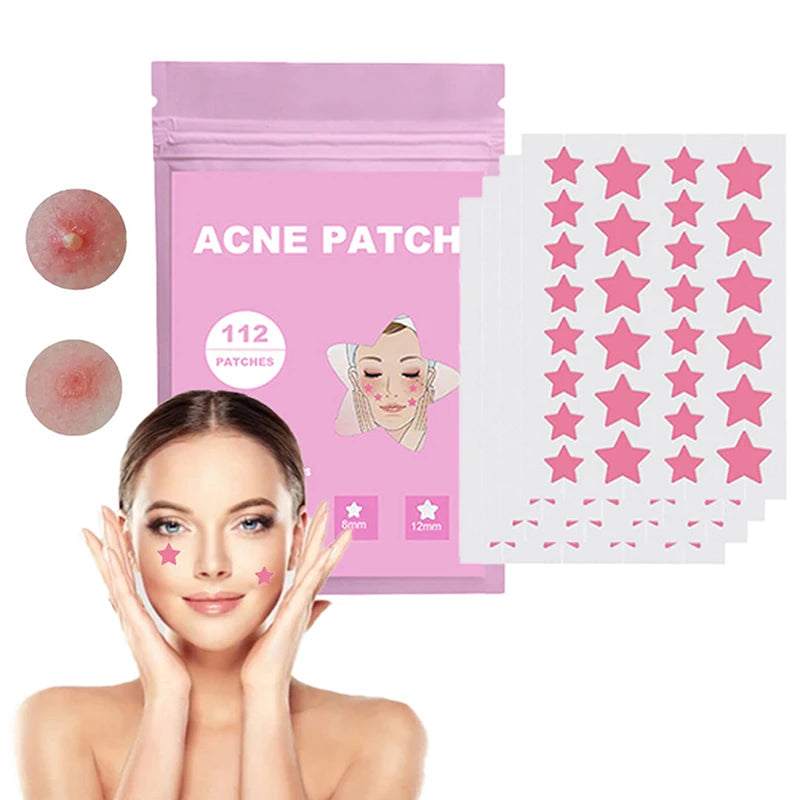 Patchs Anti-Boutons Colorés – 112 pcs – Étoiles Magiques - Livraison gratuite !